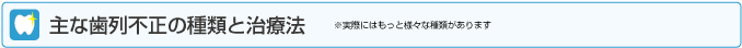 主な歯列不正の種類と治療法