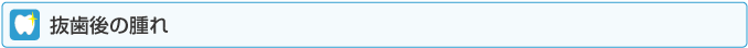 抜歯後の腫れ